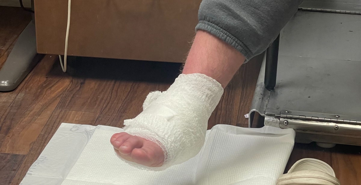 A bandaged foot